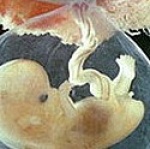 Life begins at Conception